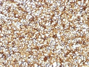 SPTBN2 Antibody / Spectrin beta III - image 1