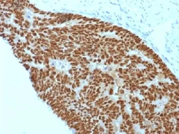 CDX2 Antibody - image 1