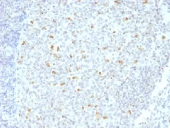 Bcl6 Antibody - image 1
