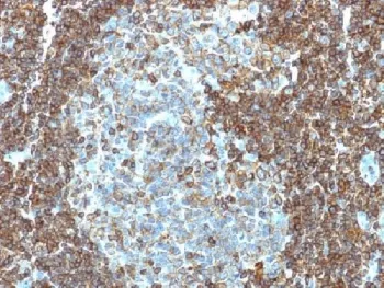 CD3 epsilon Antibody - image 1