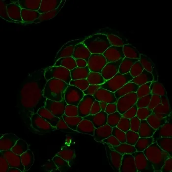 EpCAM Antibody - image 1