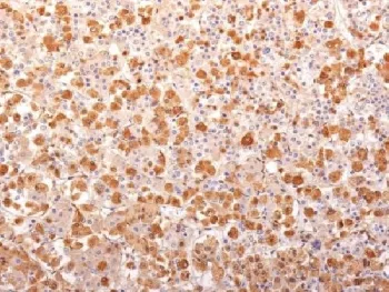 POMC Recombinant Antibody / ACTH / N-Terminal - image 1