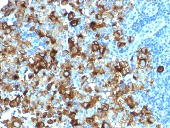PMEL17 / Melanoma gp100 Recombinant Antibody - image 1