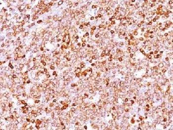 CD79a Recombinant Antibody - image 1