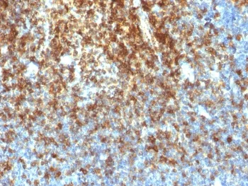 CD43 Recombinant Antibody - image 1