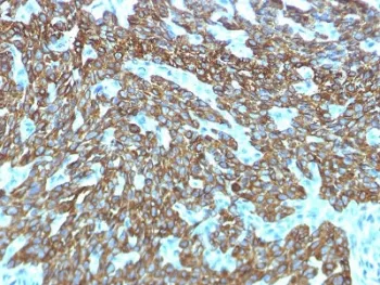 Basic Cytokeratin Recombinant Antibody - image 1