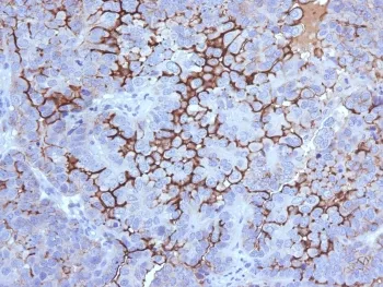 MUC16 Antibody / CA125 - image 1
