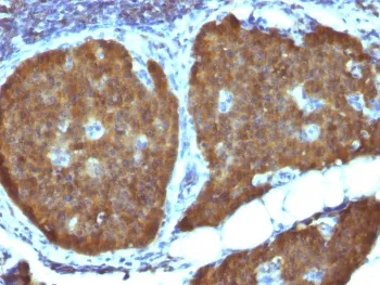 NSE Antibody / Neuron Specific Enolase - image 1