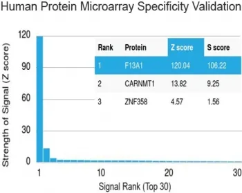 Factor XIIIa Antibody / F13A1 - image 1