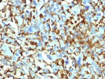 Factor XIIIa Antibody / F13A1 - image 1