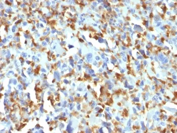 Factor XIIIa Antibody / F13A1 - image 1