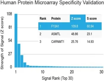 Factor XIIIa Antibody / F13A1 - image 1
