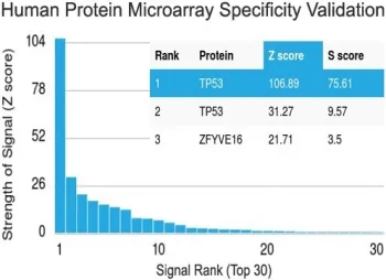p53 Recombinant Antibody / TP53 - image 1