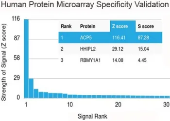 TRAcP Recombinant Antibody / TRAP / ACP5 - image 1