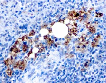 TRAcP Recombinant Antibody / TRAP / ACP5 - image 1