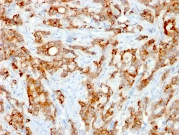Beta-2 Microglobulin Recombinant Antibody - image 1
