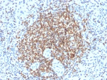 Bcl-2 Recombinant Antibody - image 1