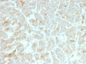 CFTR Recombinant Antibody / Cystic Fibrosis Transmembrane Regulator - image 1