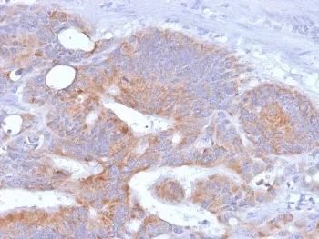 CD86 Recombinant Antibody - image 1