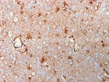 S100B Recombinant Antibody - image 1