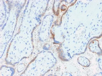 HCG-beta Recombinant Antibody - image 1
