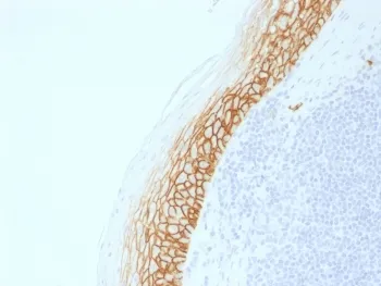 CD44v9 Recombinant Antibody - image 1