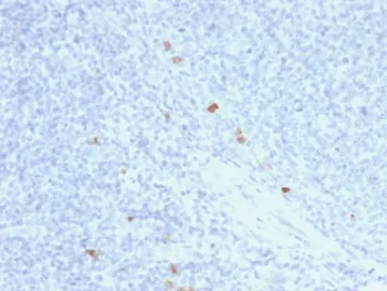 Human IgG4 Recombinant Antibody - image 1