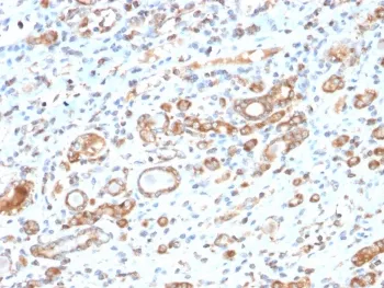HSP60 Recombinant Antibody - image 1
