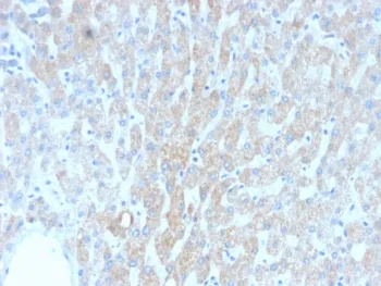 HSP60 Recombinant Antibody - image 1