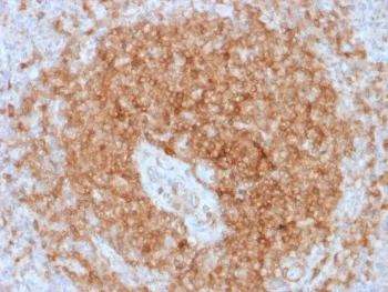 CD79a Recombinant Antibody - image 1