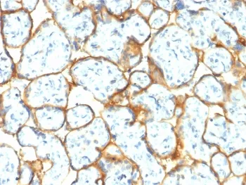Insulin Receptor alpha Recombinant Antibody - image 1