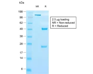 TIMP1 Recombinant Antibody - image 1