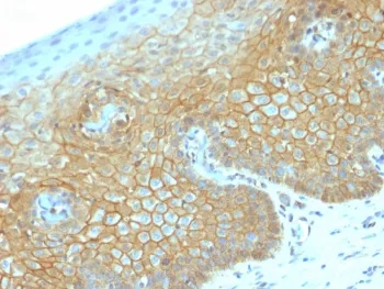 Beta Catenin Recombinant Antibody - image 1
