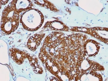 Beta Catenin Recombinant Antibody - image 1