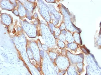 HCG-beta Recombinant Antibody - image 1