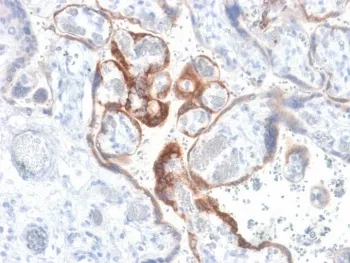 HCG-beta Recombinant Antibody - image 1