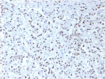 WT1 Recombinant Antibody / Wilms Tumor 1 - image 1