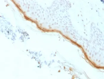 Filaggrin Recombinant Antibody - image 1