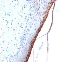 Filaggrin Recombinant Antibody - image 1