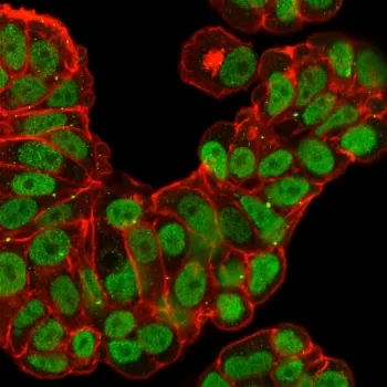 FOXA1 Recombinant Antibody - image 1