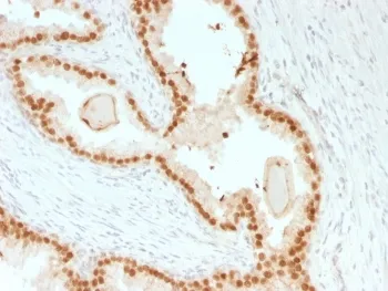 FOXA1 Recombinant Antibody - image 1