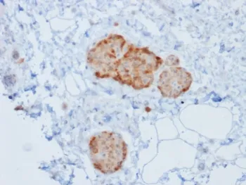 Chromogranin A Recombinant Antibody - image 1