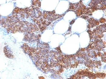 Parathyroid Hormone Recombinant Antibody / N Terminal - image 1