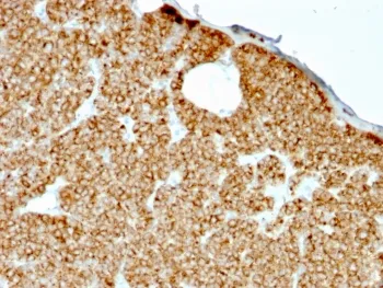 Parathyroid Hormone Recombinant Antibody / N Terminal - image 1