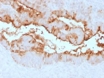 MUC16 Recombinant Antibody / CA125 - image 1