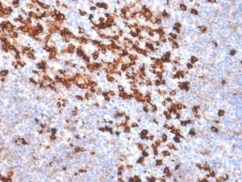 Biotin / Vitamin B7 / Vitamin H Recombinant Antibody - image 1