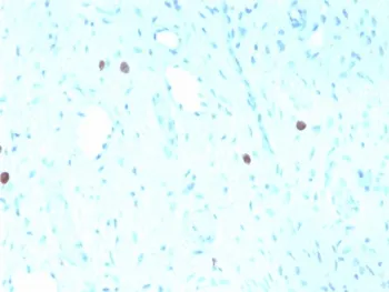 HPV-16 L1 Recombinant Antibody - image 1
