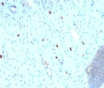 HPV-16 L1 Recombinant Antibody - image 1