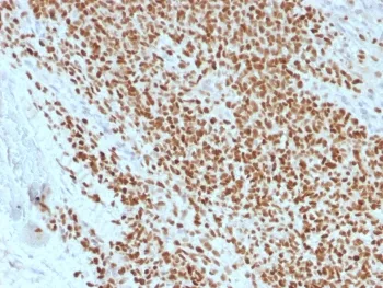 NKX2.2 Recombinant Antibody - image 1