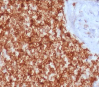 Bcl-2 Recombinant Antibody - image 1